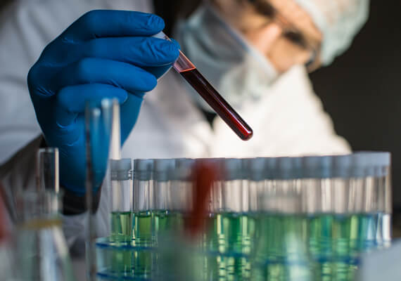 Composite Bonding